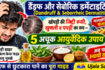 डैंड्रफ और सेबोरिक डर्मेटाइटिस के कारण, लक्षण और स्कैल्प केयर के उपाय