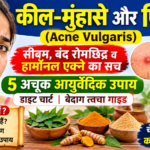 कील-मुंहासे और पिंपल्स के कारण, 5 आयुर्वेदिक उपाय और साफ त्वचा के टिप्स