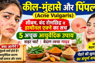 कील-मुंहासे और पिंपल्स के कारण, 5 आयुर्वेदिक उपाय और साफ त्वचा के टिप्स